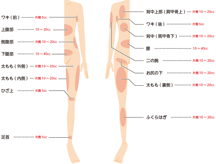 BNLS脂肪溶解注射の施術範囲一覧