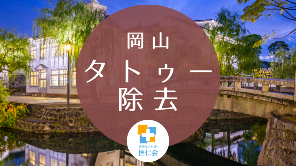 岡山 タトゥー除去