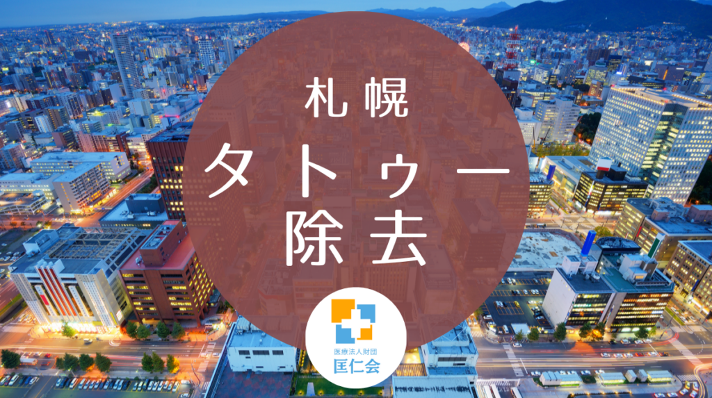 札幌 タトゥー除去