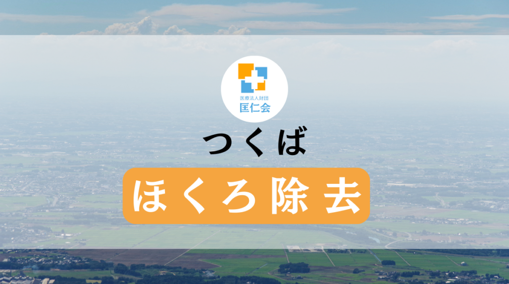 つくば ほくろ除去 安い