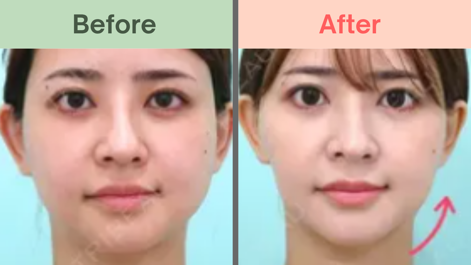 ワムクリニック銀座症例