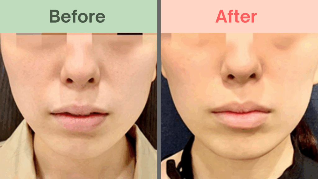 ルラクリニック症例