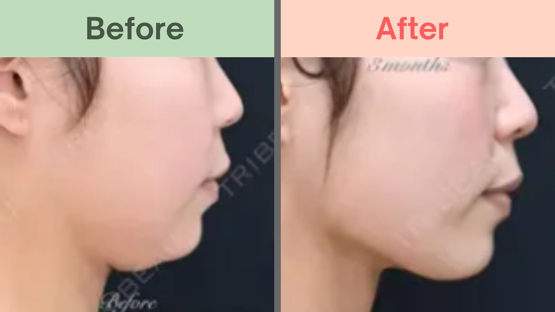 湘南美容クリニック症例